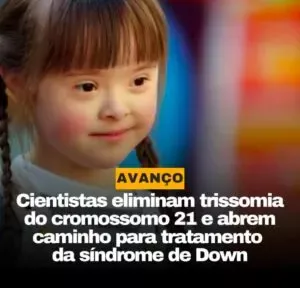 Cientistas Removem Cromossomo Extra da Síndrome de Down e Abrem Caminho Para o Tratamento